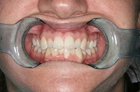 6 Month Smiles 37849