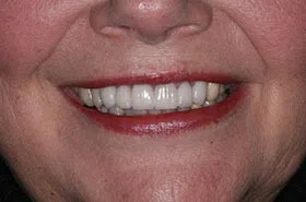 Dentist in Powell TN