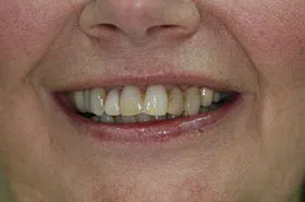 Powell TN Cosmetic Dentist,