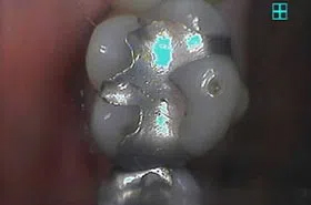 Emergency Dentist in Powell TN