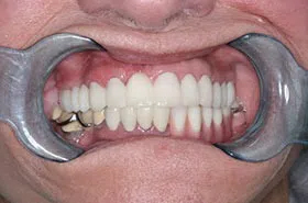 Cosmetic Dentist Powell TN