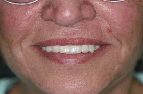 Powell TN Cosmetic Dentist,
