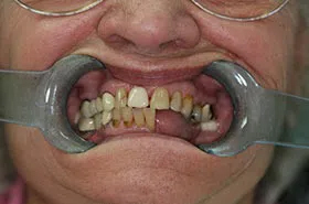 Cosmetic Dentist Powell TN