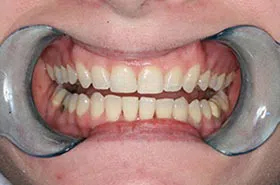 Orthodontist Powell TN