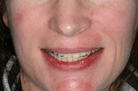 Orthodontics Powell TN