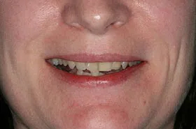 Powell TN Orthodontics