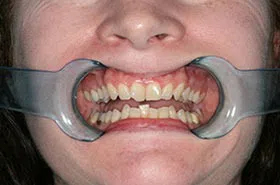 Orthodontist in Powell TN