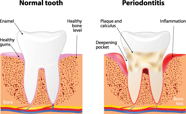 Kennedy Dentistry | Ceramic Crowns, Diode Laser and Dental Bridges