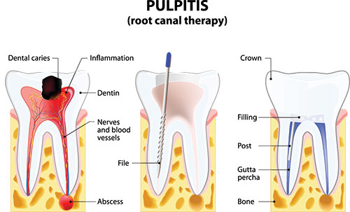 Kennedy Dentistry | Overjet AI Cavity Detection, Dental Fillings and CBCT