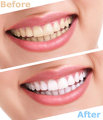 Kennedy Dentistry | Oral Exams, Oral Surgery and Teeth Whitening