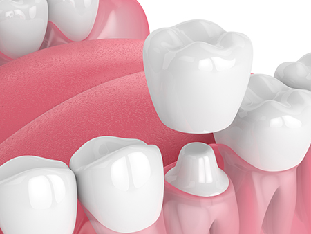 Kennedy Dentistry | Dental Fillings, Oral Surgery and Dentures